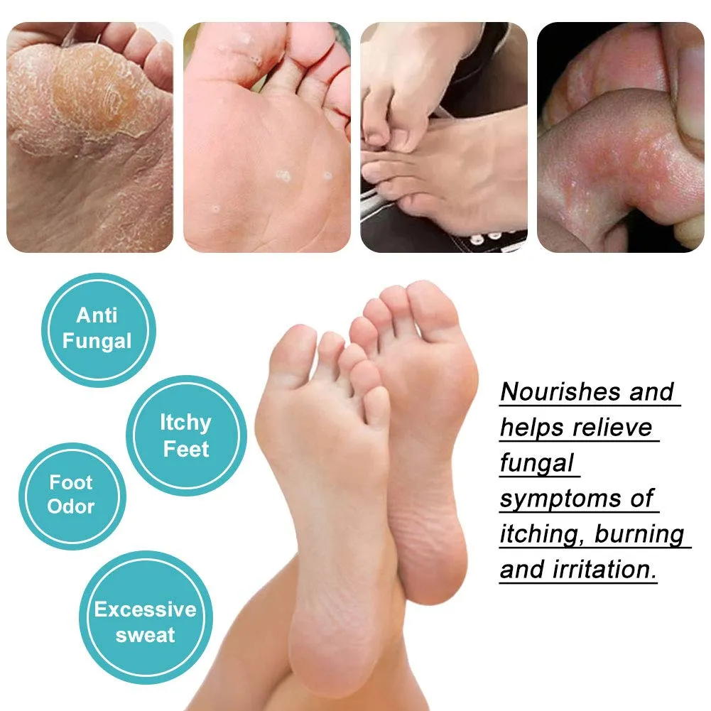 Antifungal Foot Spray, Athlete's Foot Spray Liquid, Athletes Foot Spray, Antifungal Deodorant, Anti-Fungi Treatment of Athletes Foot and Ringworm, Prevents Reinfection Soothe Itching Blue