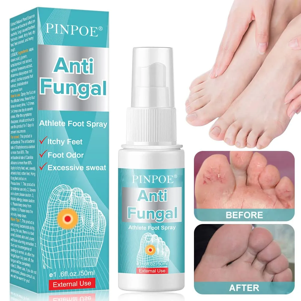 Antifungal Foot Spray, Athlete's Foot Spray Liquid, Athletes Foot Spray, Antifungal Deodorant, Anti-Fungi Treatment of Athletes Foot and Ringworm, Prevents Reinfection Soothe Itching Blue